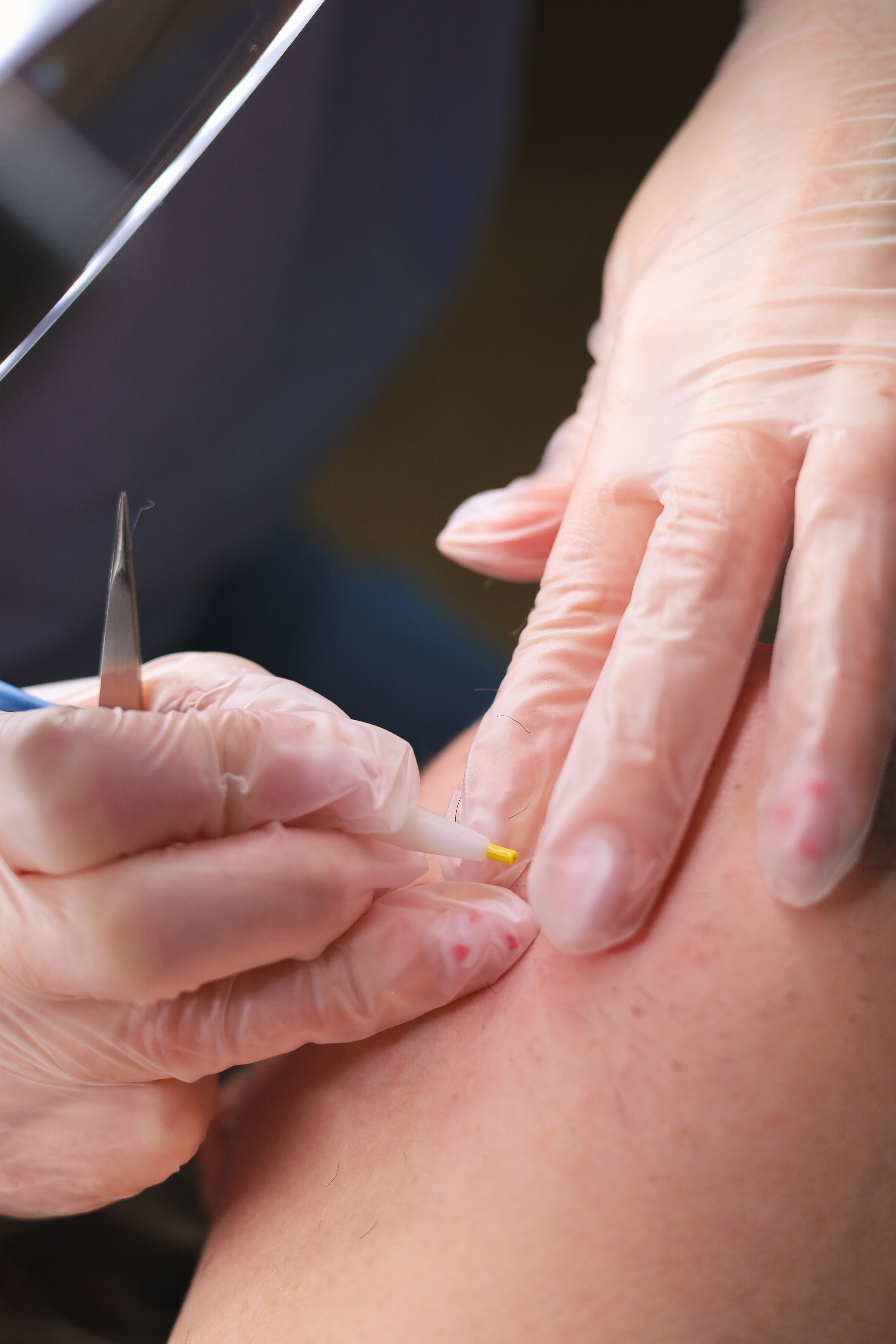 Infi Derm - photo 10